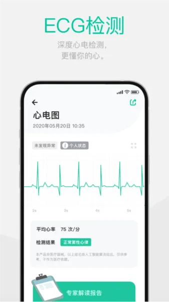 戴乐行DynasynQ血糖手表